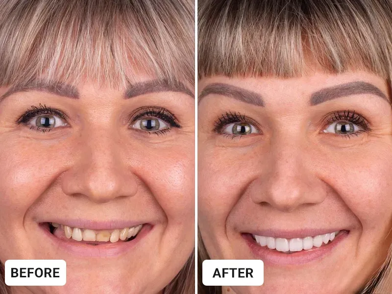 Before image for Karen, 52